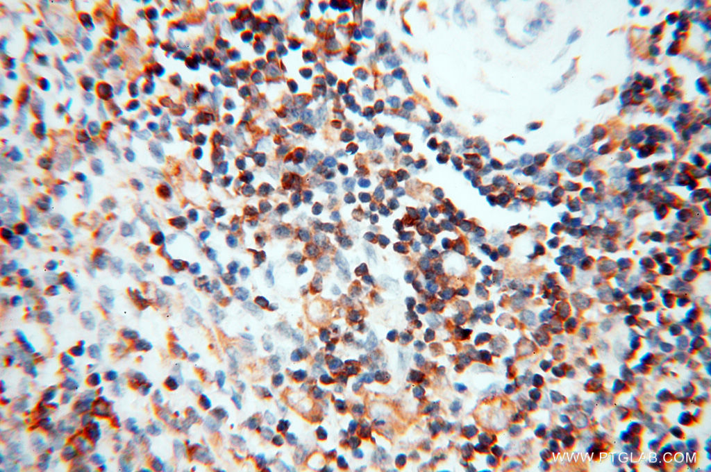 BIN2 Polyclonal antibody