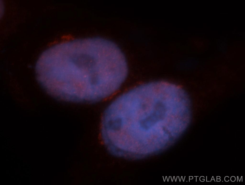 MBD3 Polyclonal antibody