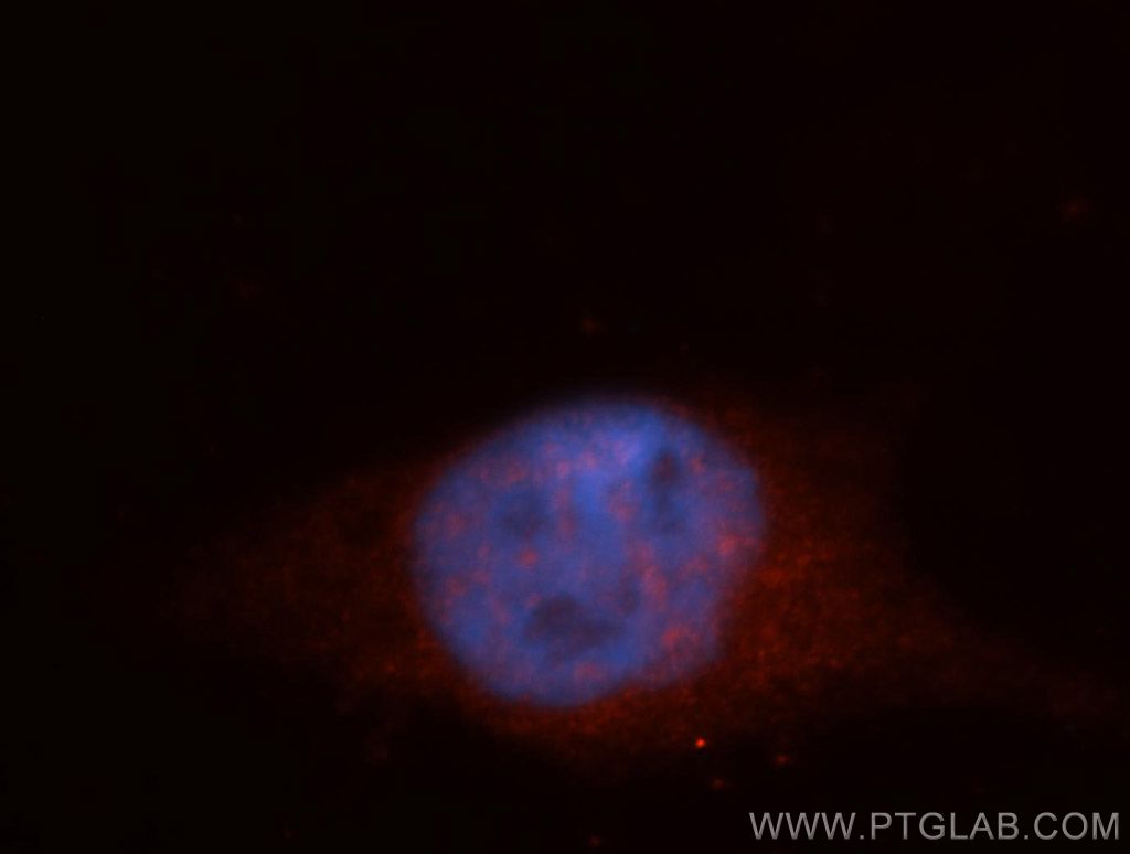 ITPKC Polyclonal antibody