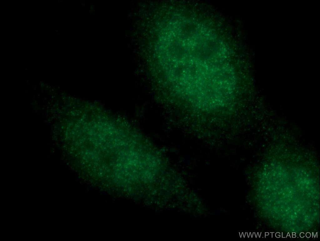 CEBPE Polyclonal antibody