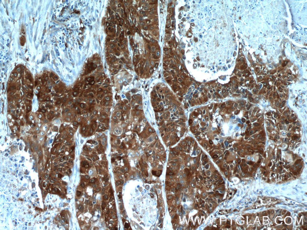 SRX1 Polyclonal antibody