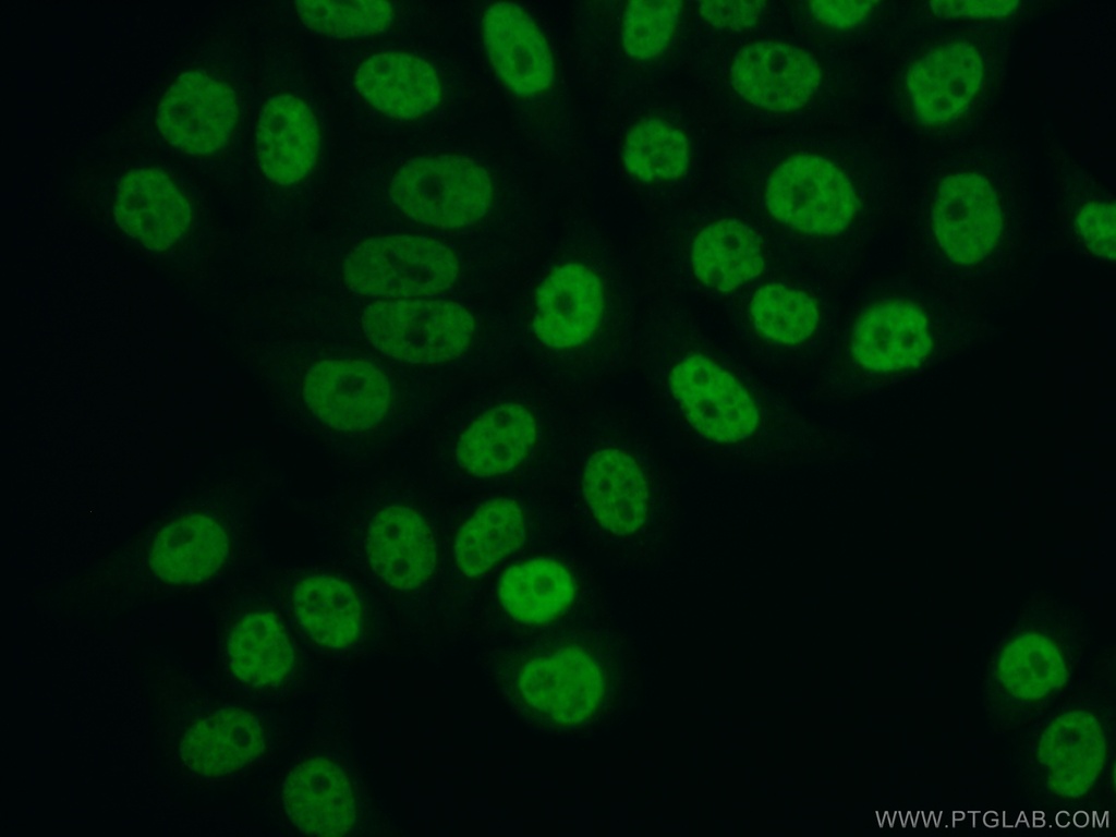 FBXO18 Polyclonal antibody