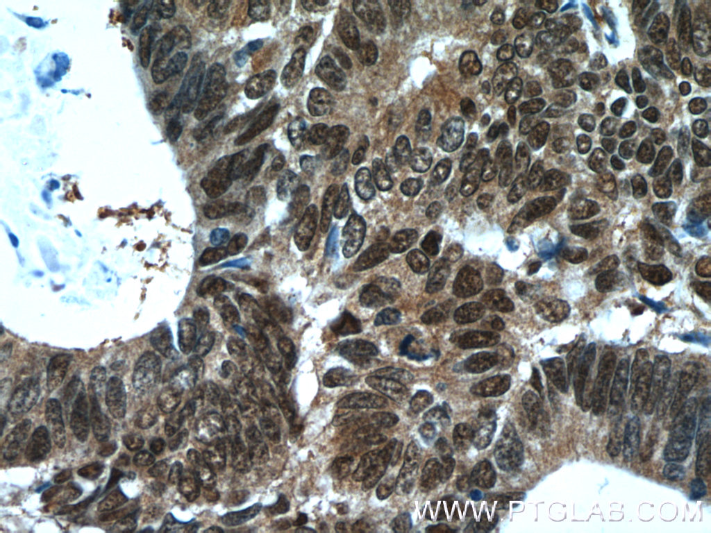 ZWILCH Polyclonal antibody