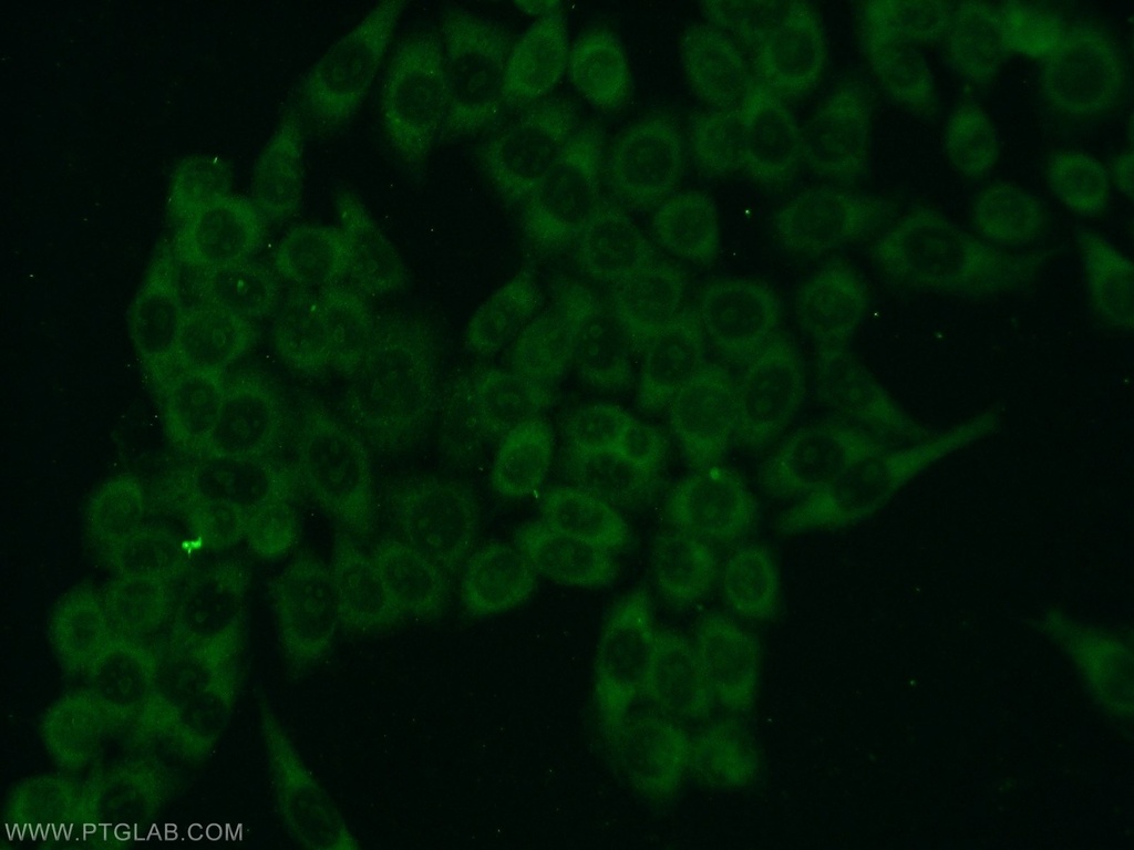 FN3K Polyclonal antibody