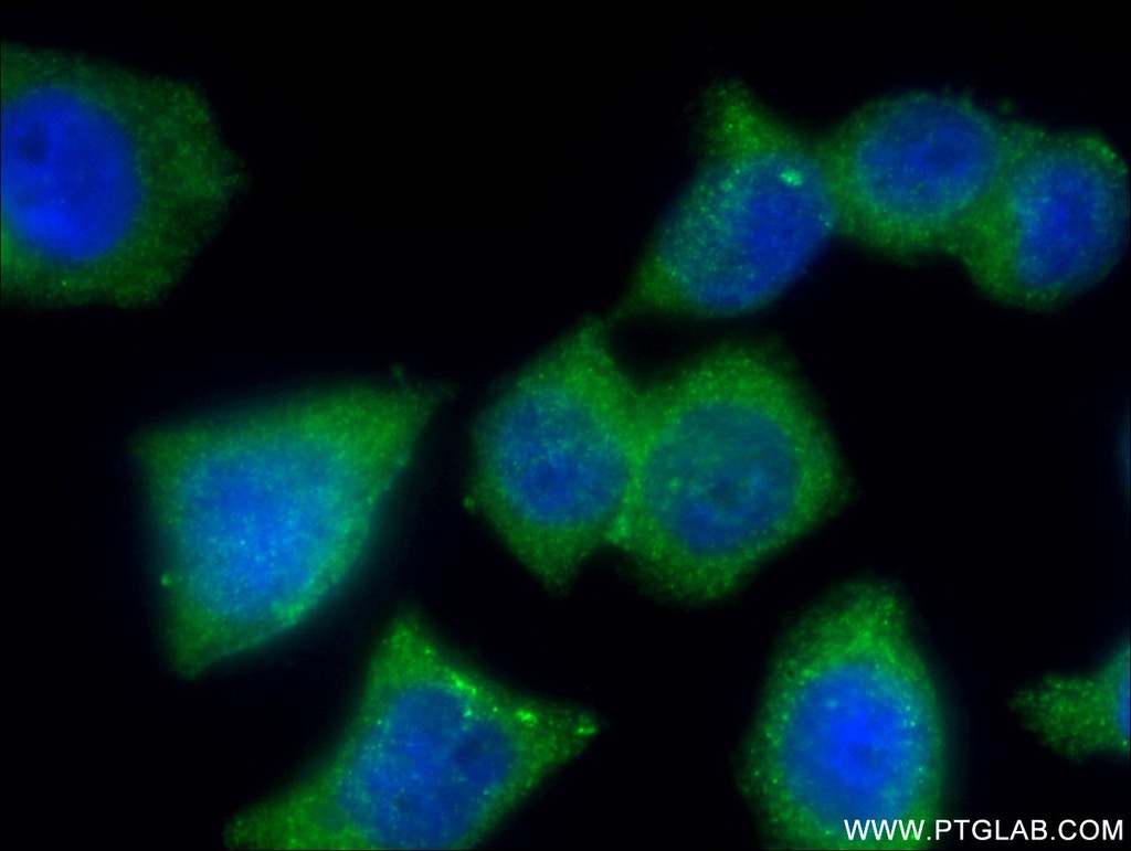 APPL2 Polyclonal antibody