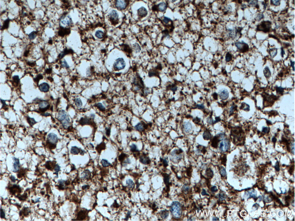 GLUD1 Polyclonal antibody