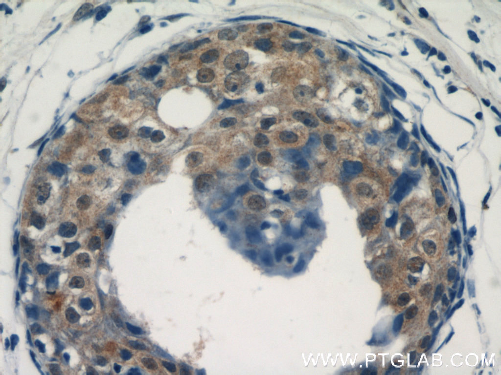 ACK1 Polyclonal antibody