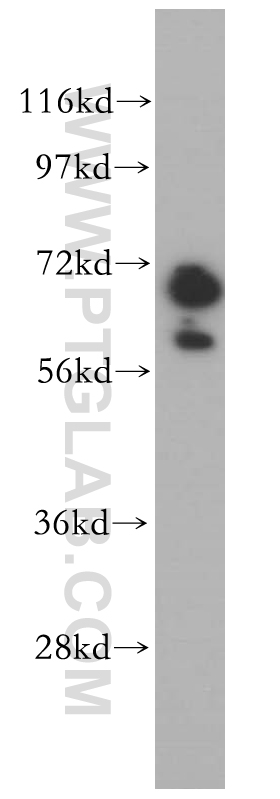 GAN Polyclonal antibody