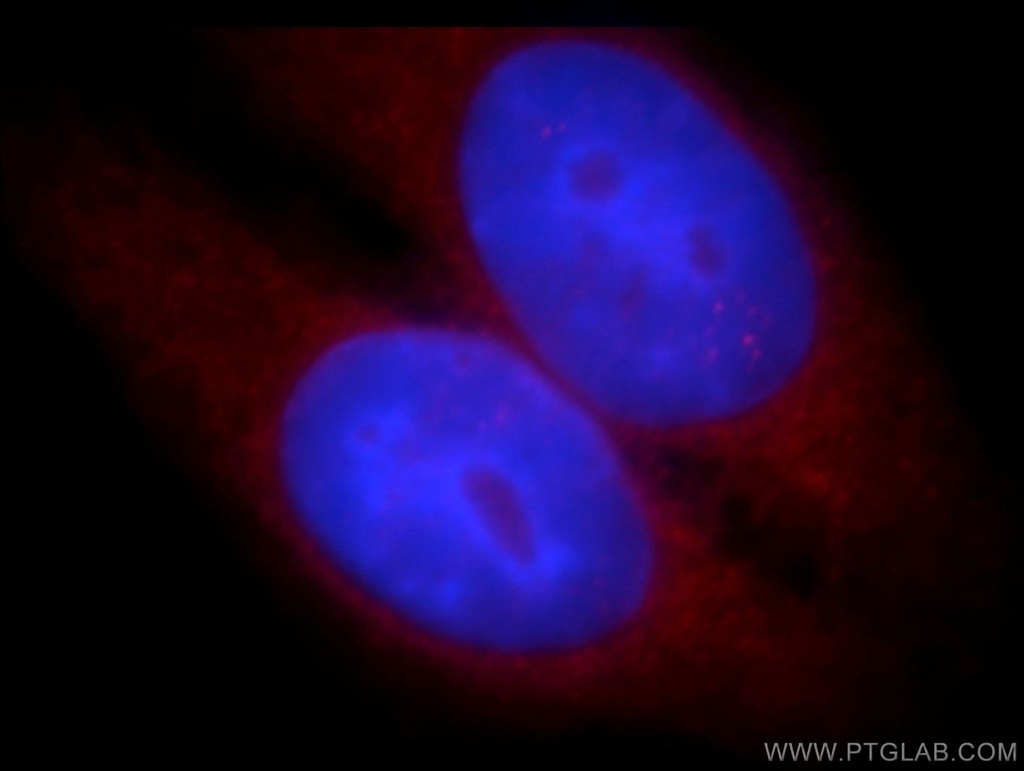 WASL Polyclonal antibody