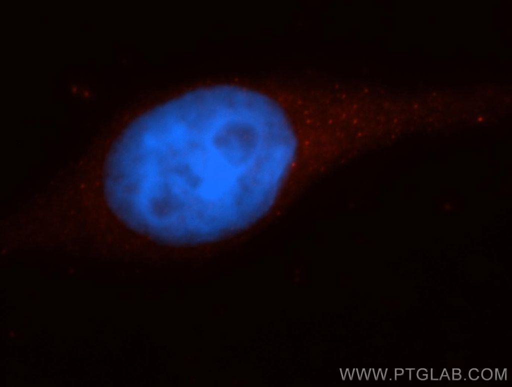 Caspase 10/p23/17/p12 Polyclonal antibody
