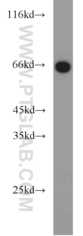 PGT Polyclonal antibody