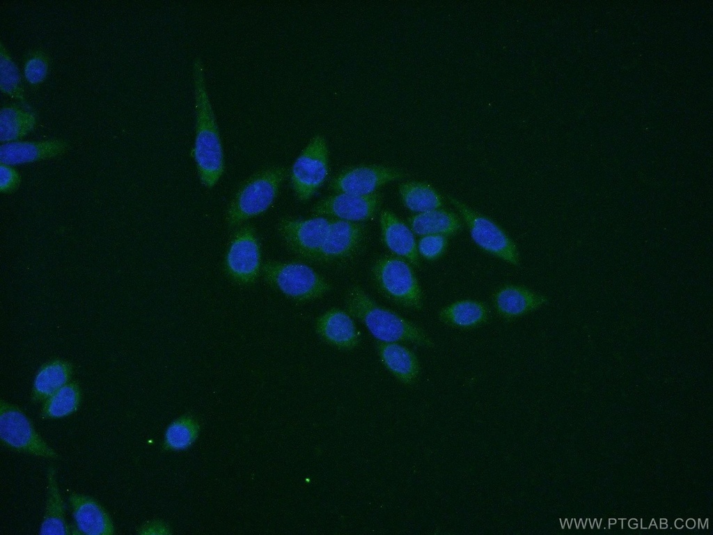 MAPKAPK5 Polyclonal antibody