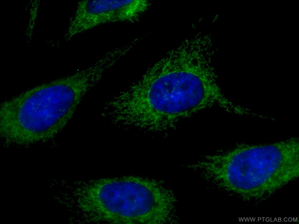 MAVS; VISA Polyclonal antibody