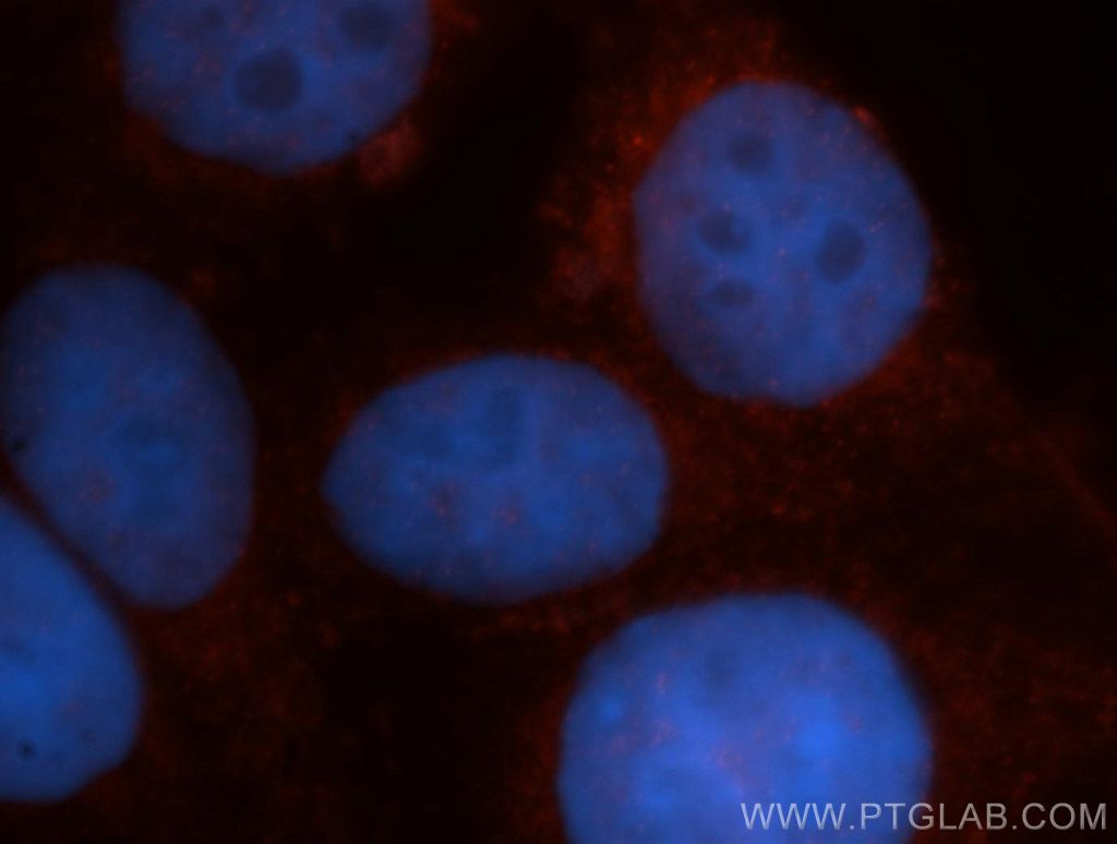 VBP1 Polyclonal antibody