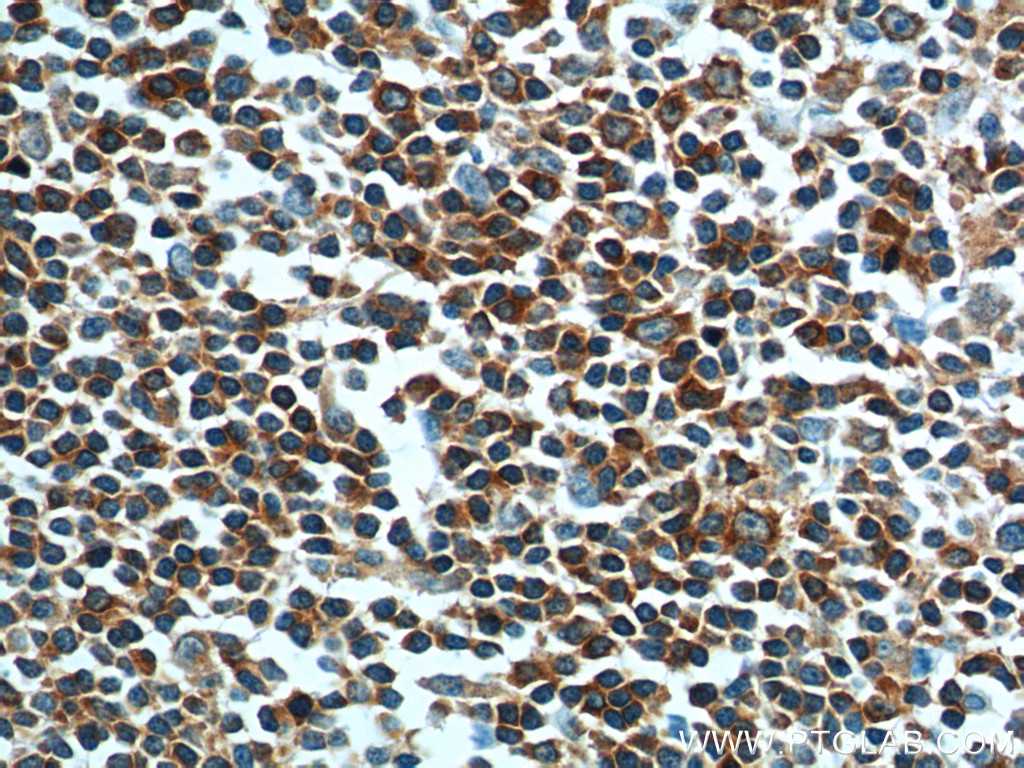 ARHGAP25 Polyclonal antibody