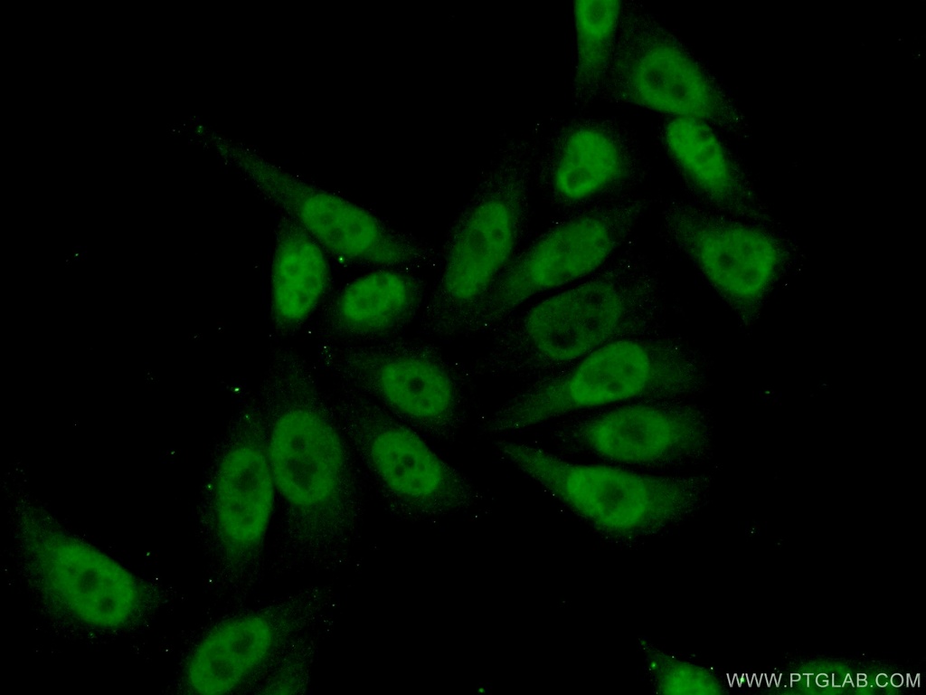 MEF2D Polyclonal antibody