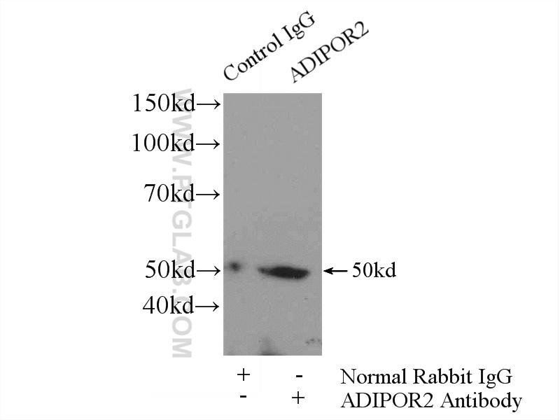 Adiponectin receptor Polyclonal antibody