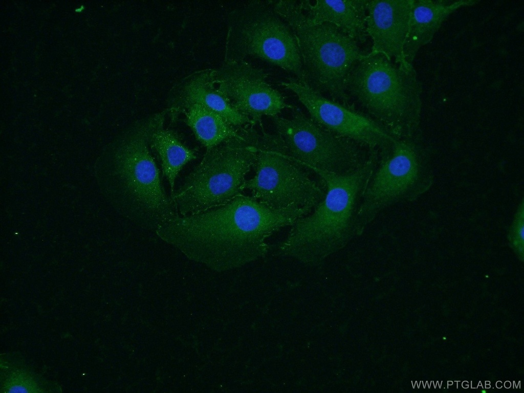 Alpha N-Catenin Polyclonal antibody