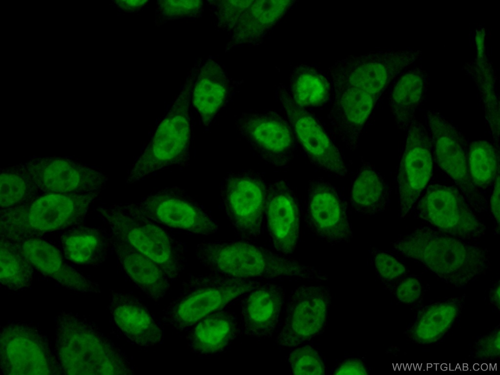RBM3 Polyclonal antibody