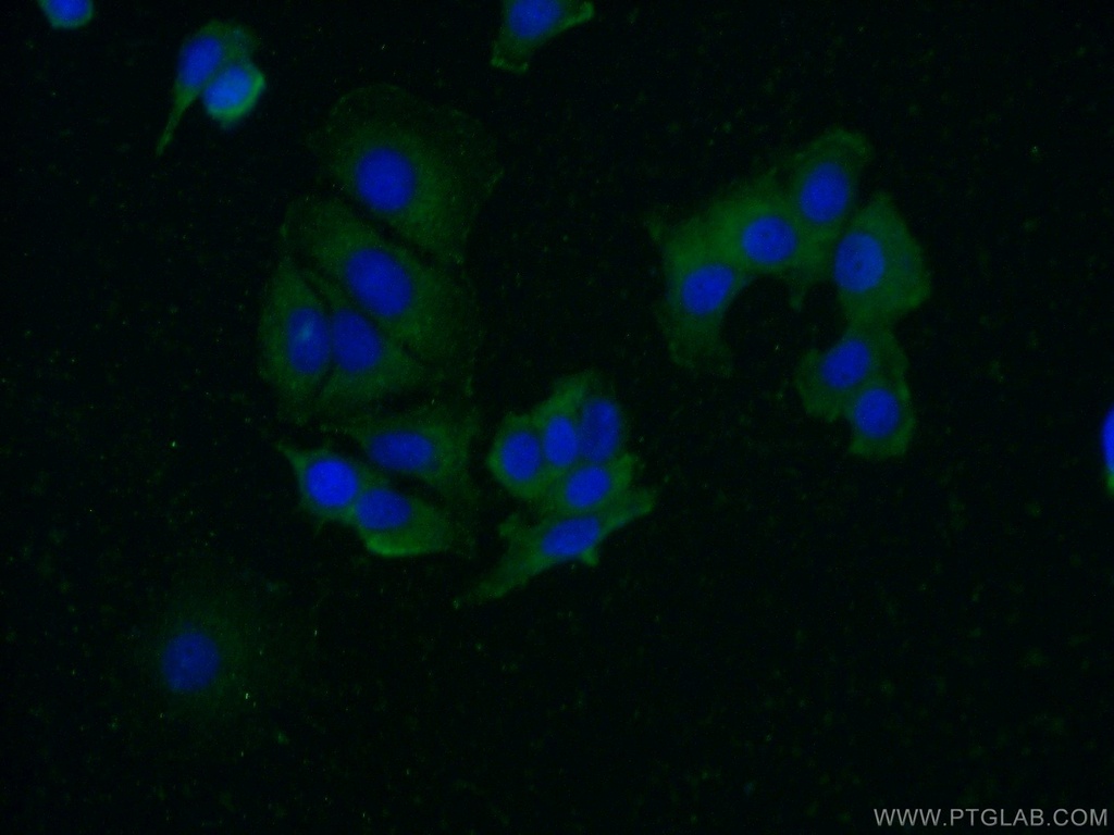FAM175A Polyclonal antibody