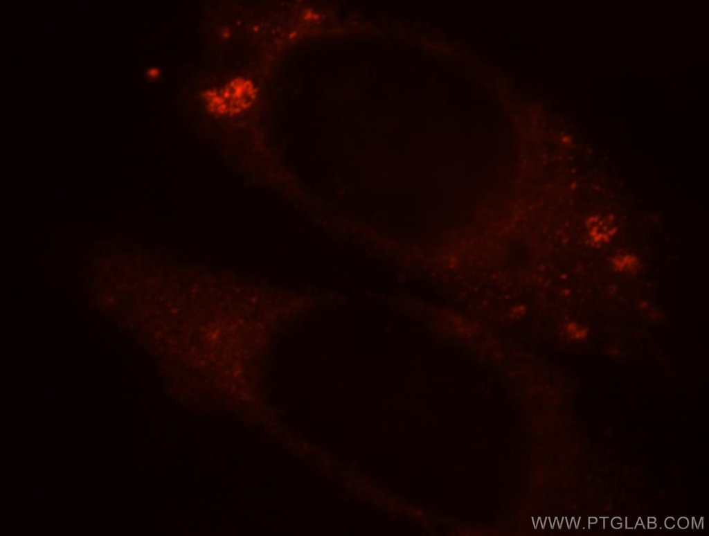 BPI Polyclonal antibody