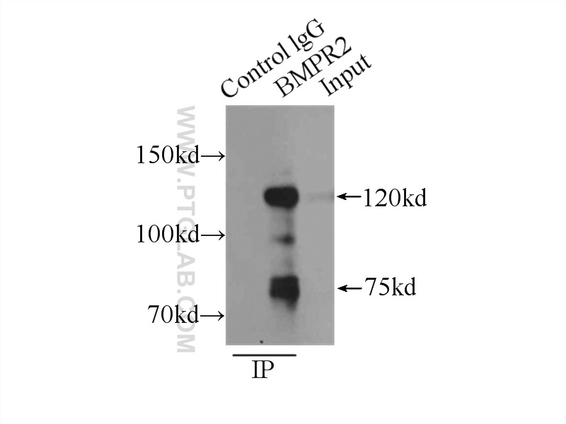 BMPR2 Polyclonal antibody