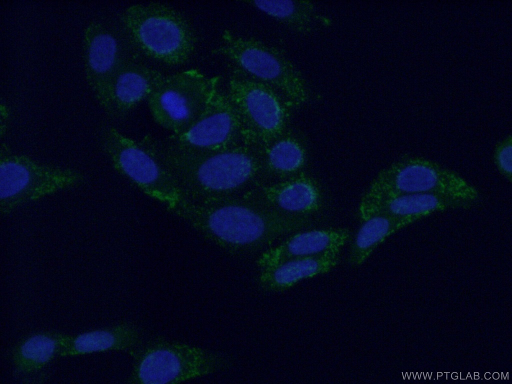 NIT1 Polyclonal antibody