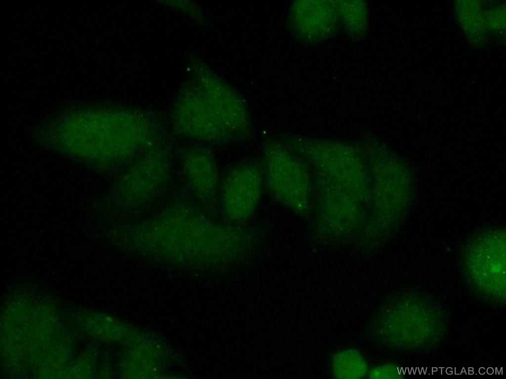 CDT1 Polyclonal antibody