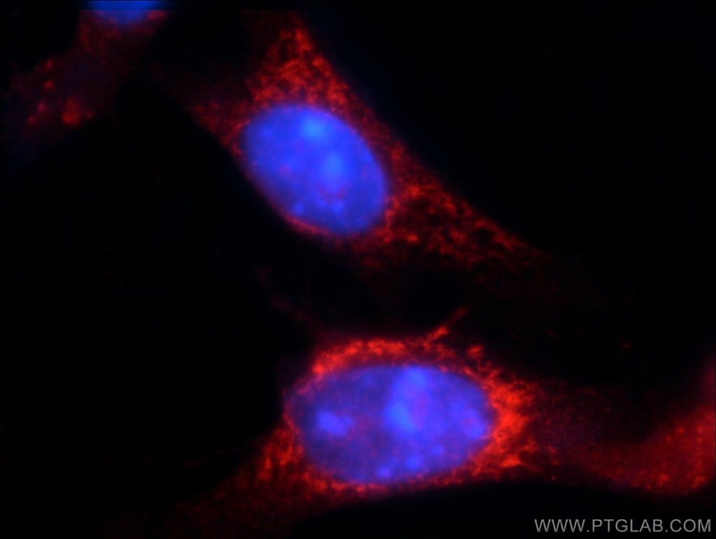 TRAF3IP1 Polyclonal antibody