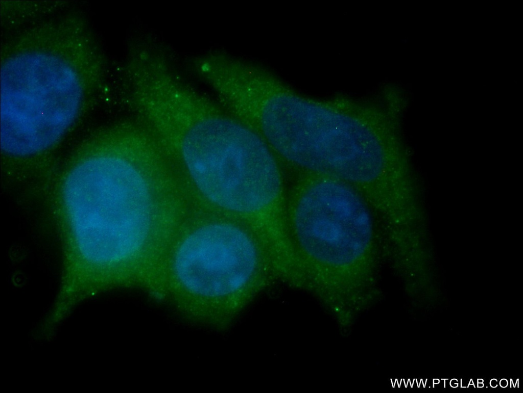 HE4 Polyclonal antibody