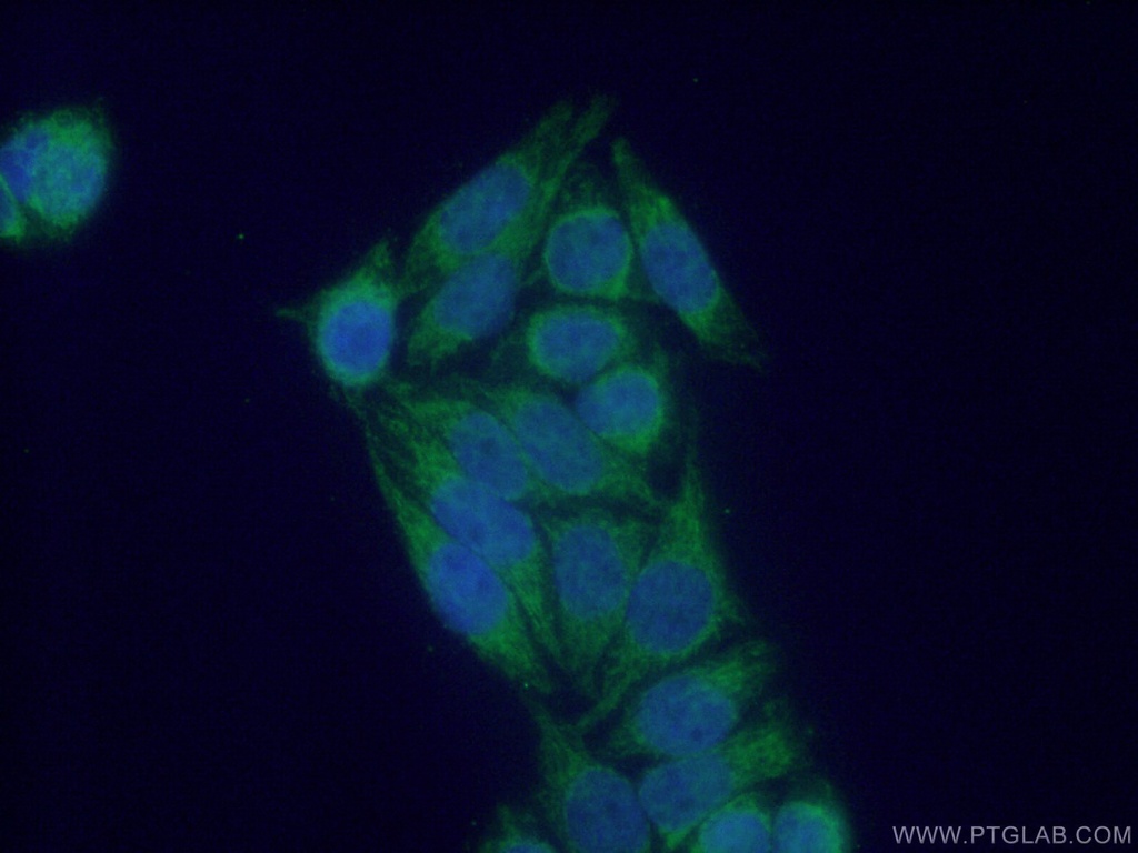 NDUFS6 Polyclonal antibody