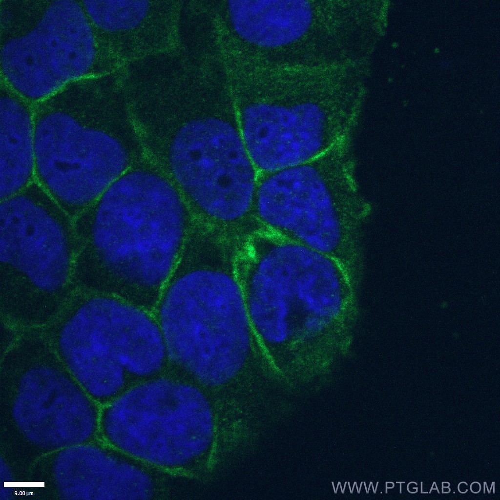 ATP1A1 Polyclonal antibody