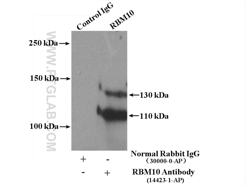 RBM10 Polyclonal antibody