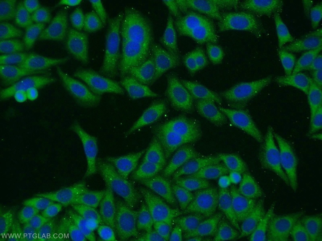TAX1BP1 Polyclonal antibody