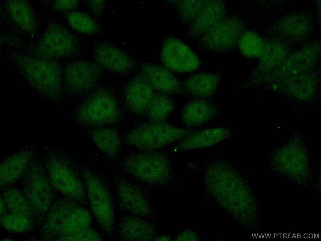 KDM5C Polyclonal antibody