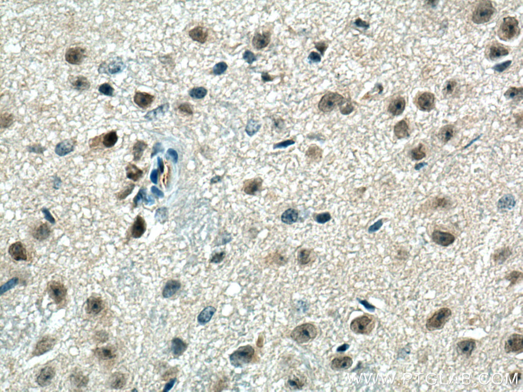 PPME1 Polyclonal antibody