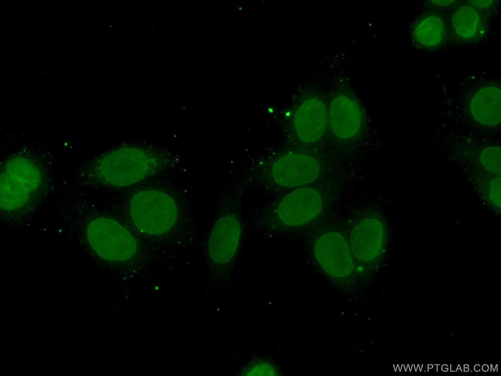 TFIP11 Polyclonal antibody