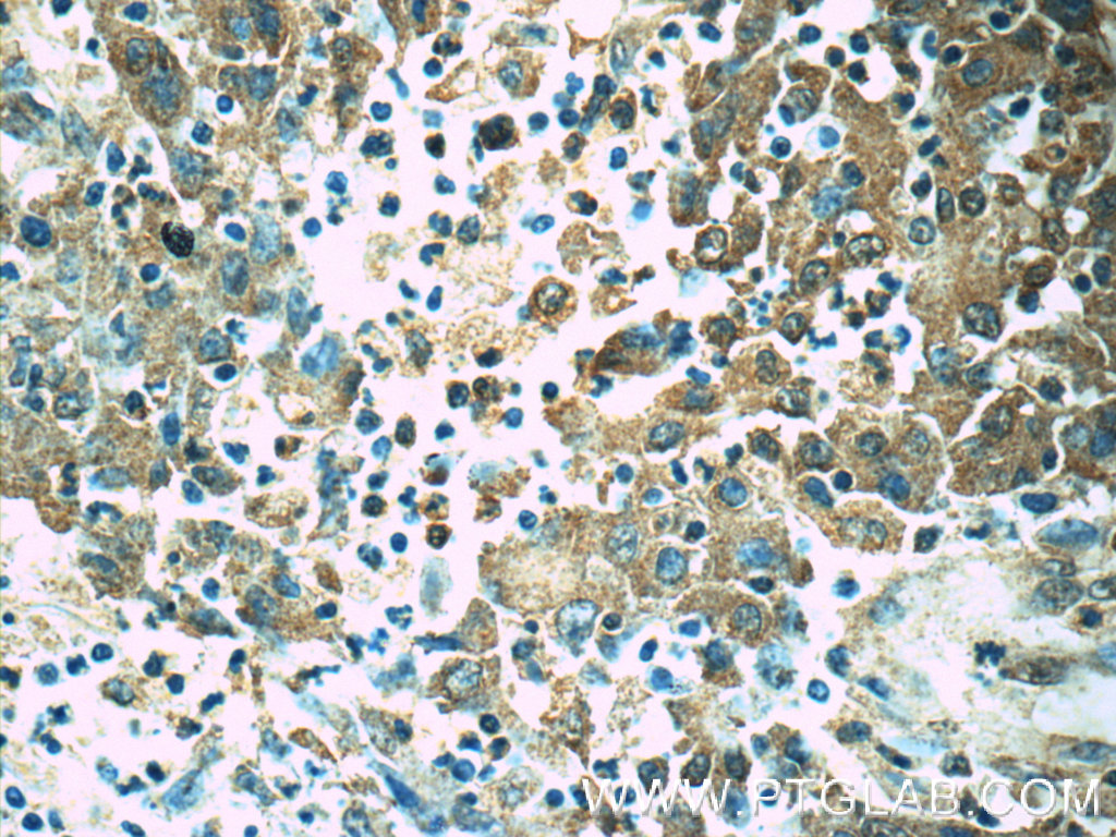 ORAI1 Polyclonal antibody
