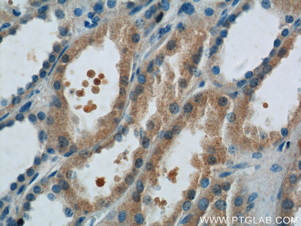 FANCL Polyclonal antibody