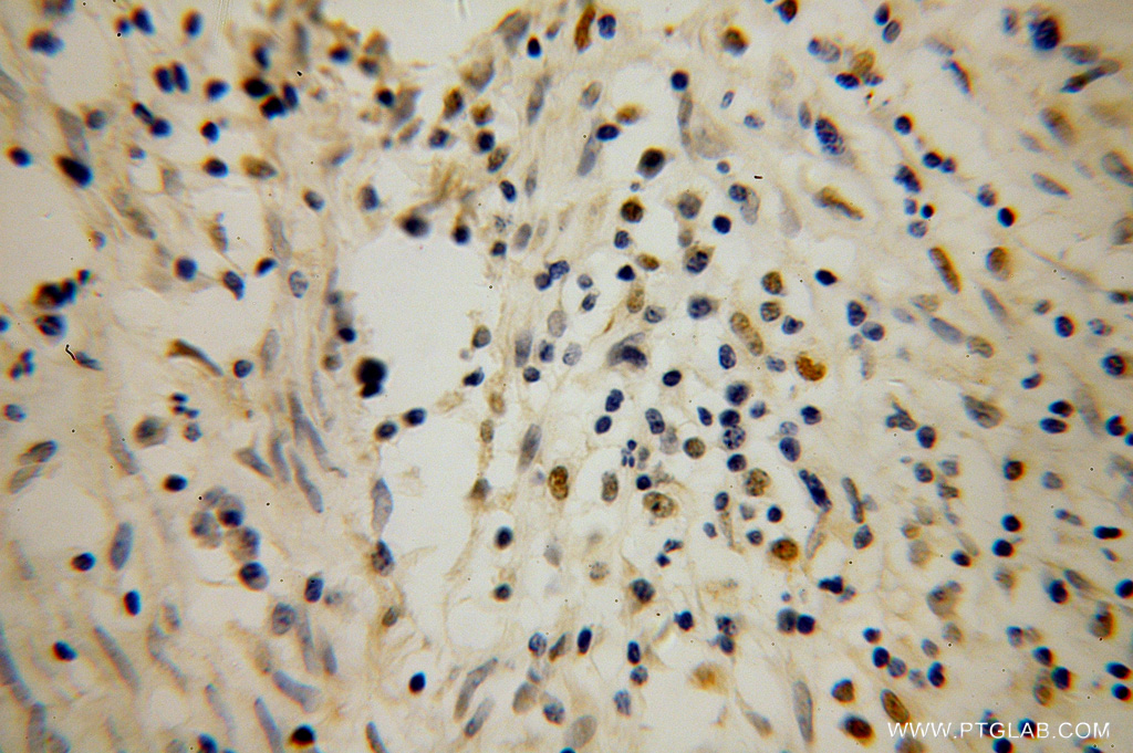 POLK Polyclonal antibody