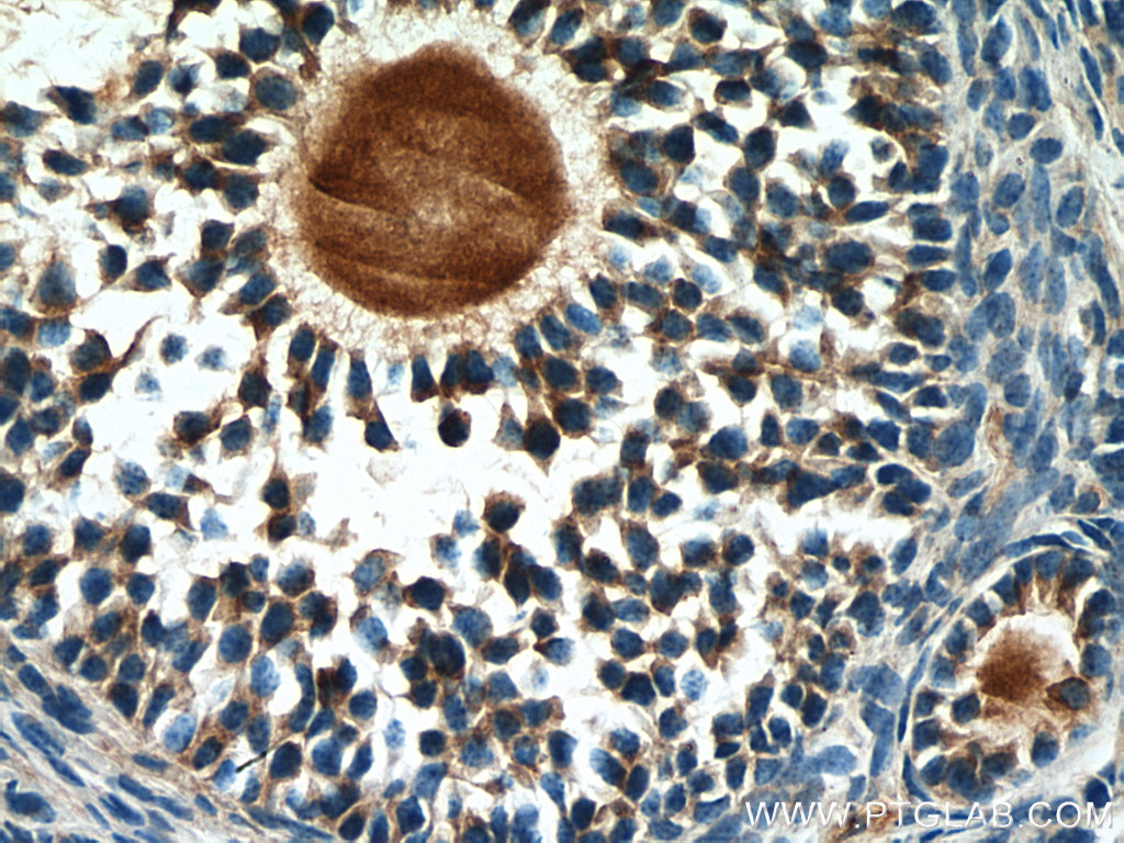 AMH Polyclonal antibody