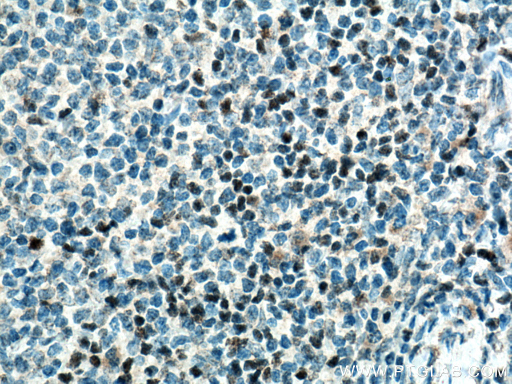 TCF7 Polyclonal antibody