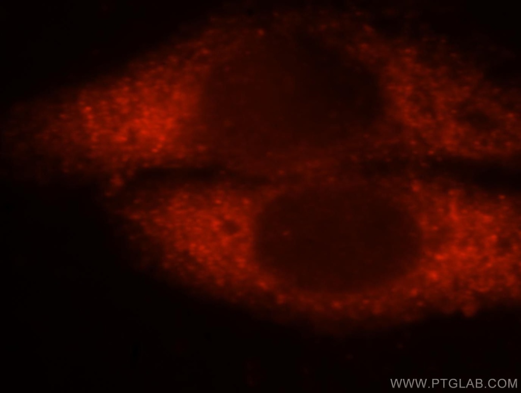 GSTA1 Polyclonal antibody