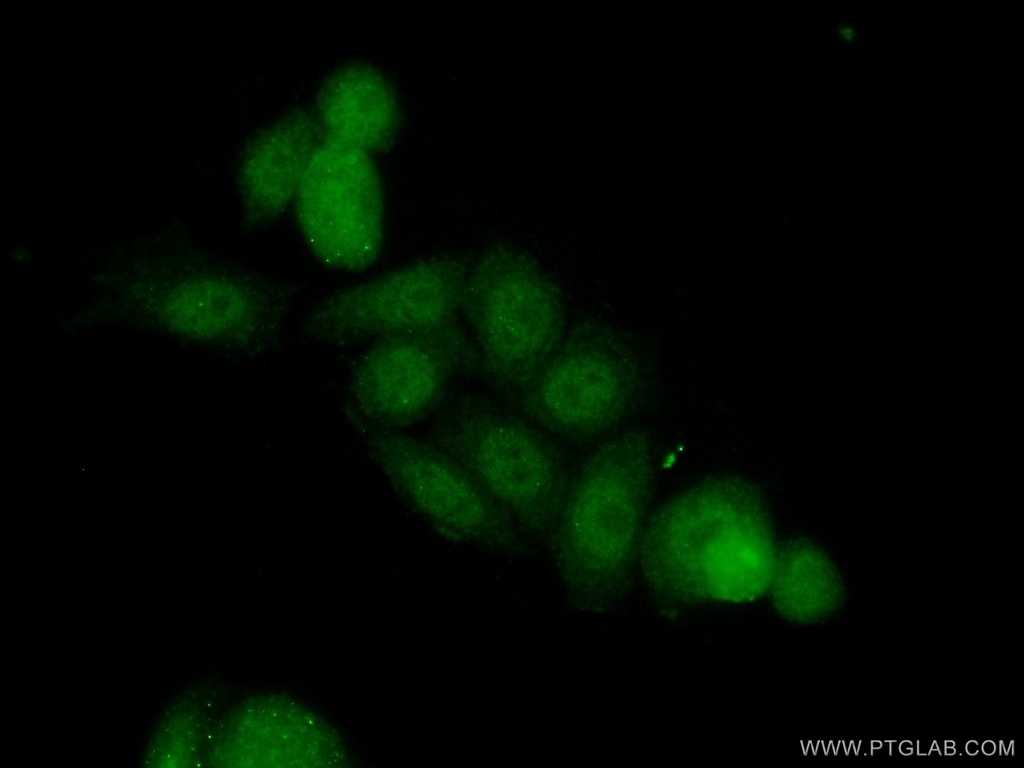LCOR Polyclonal antibody