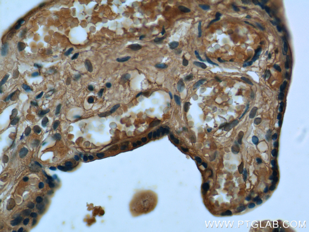 RPS7 Polyclonal antibody