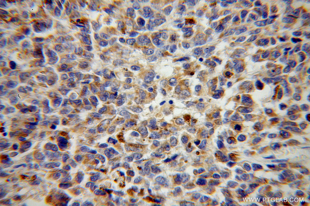 VTI1B Polyclonal antibody