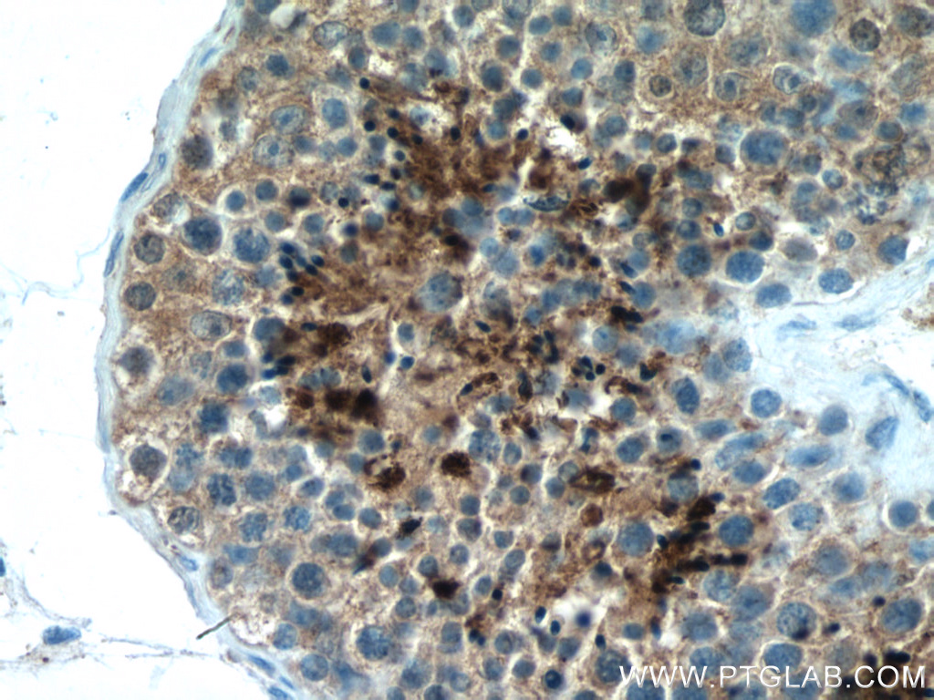 PRM2 Polyclonal antibody