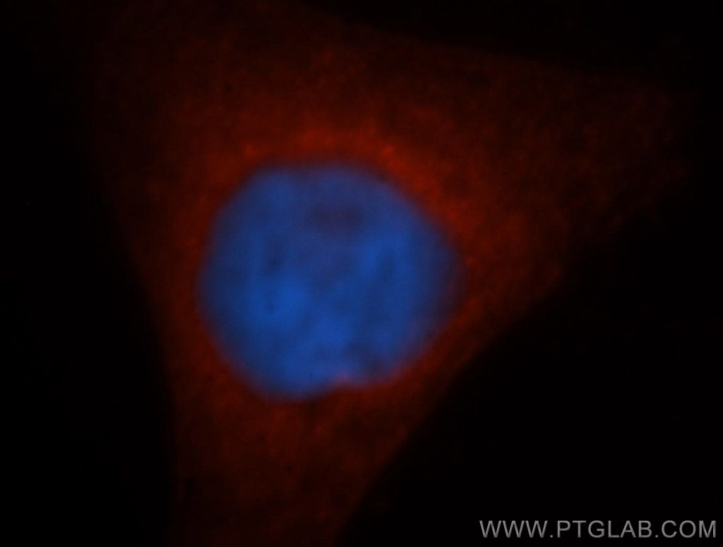 GSTM5 Polyclonal antibody