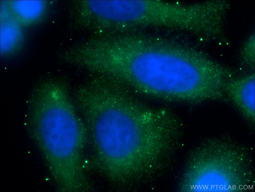 CREB3L2 Polyclonal antibody