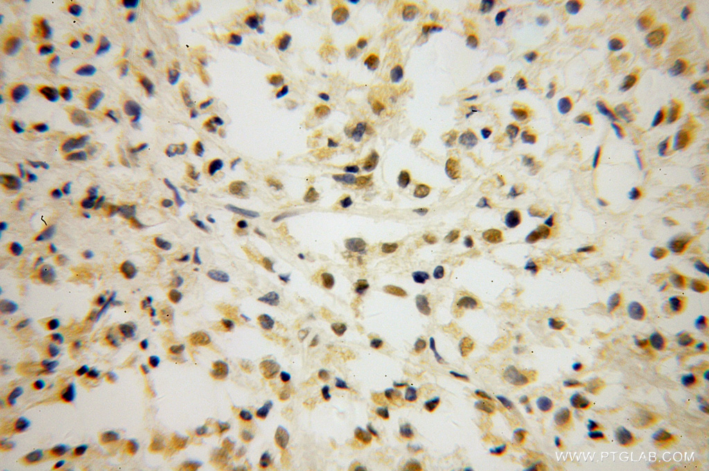 TCF7L1 Polyclonal antibody